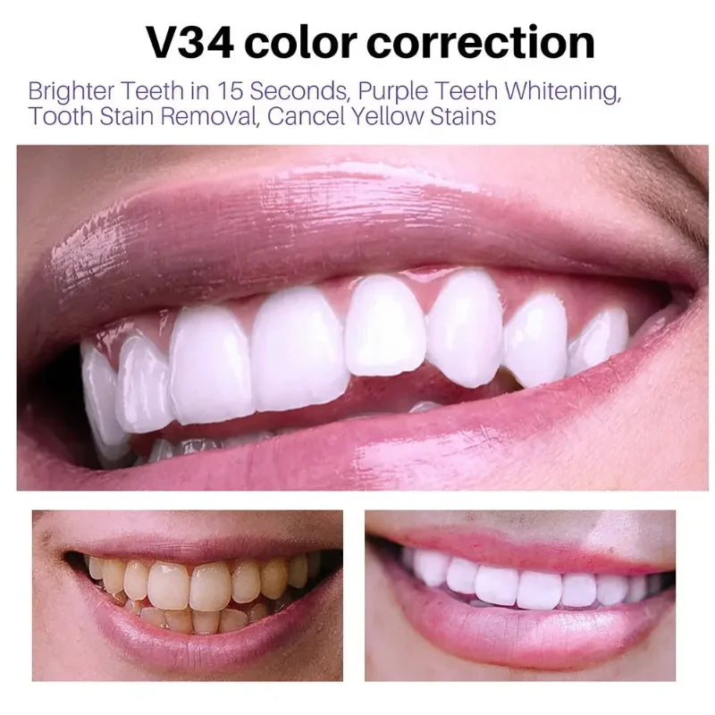 BrightSmile V34 Mousse Toothpaste