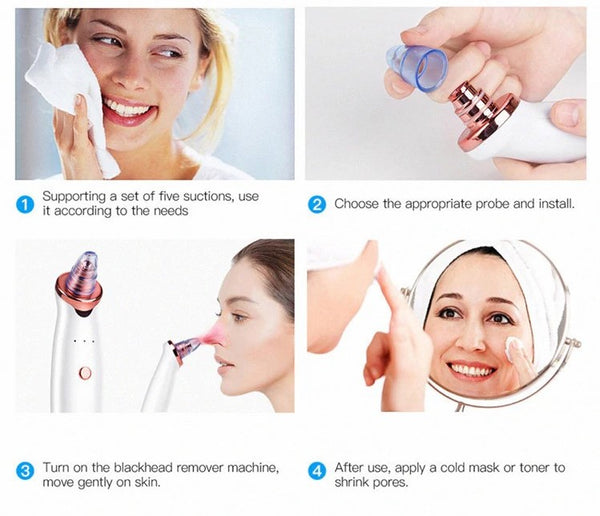 Blackhead Remover