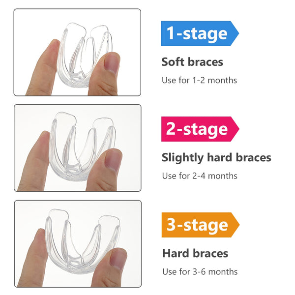 Dental Retainers