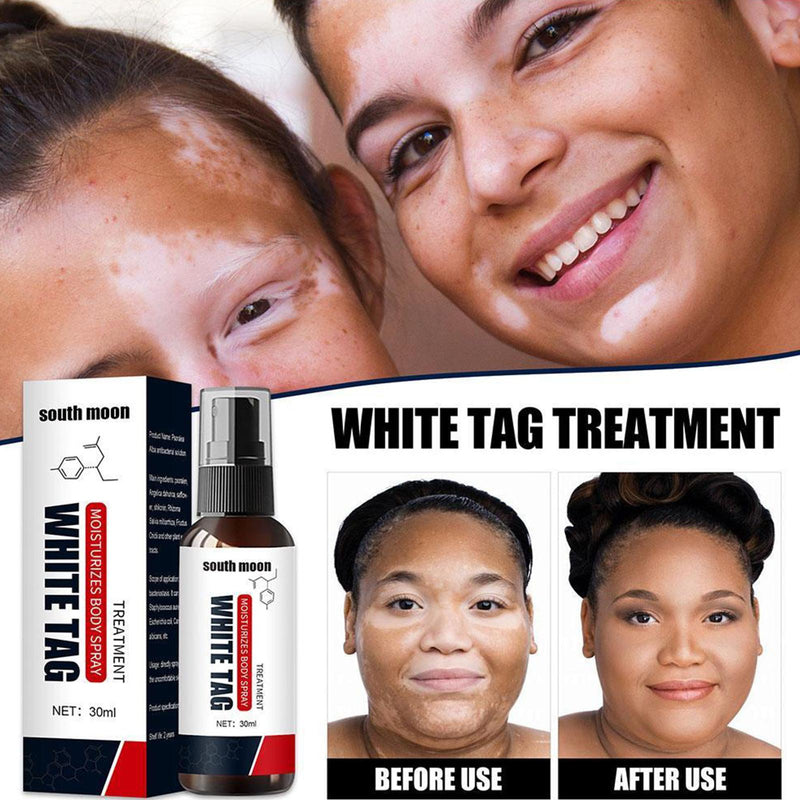 Dermax White Tag Treatment Psoriasis Treatment Spray